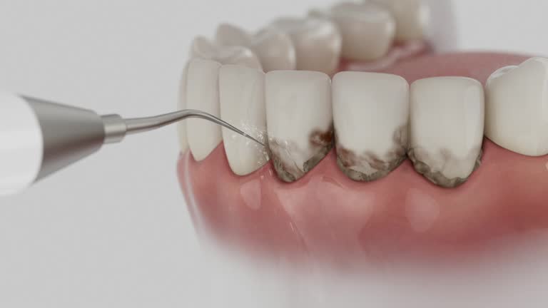 Trusted Dental Crowns And Bridges service in Naples, TX - Dentist Open Now